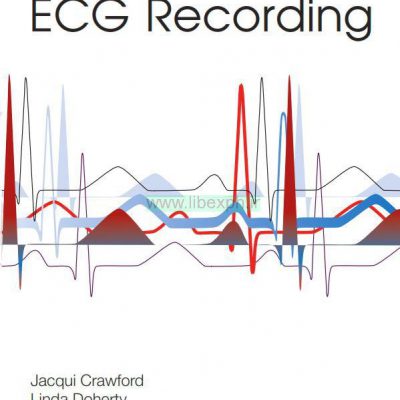 جنبه های عملی ضبط ECG